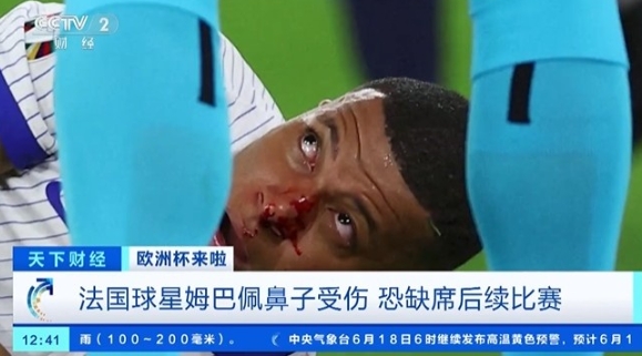 法国欧洲杯首胜背后的鼻子传奇：姆巴佩伤退引关注