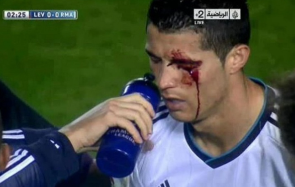 纳瓦罗回忆肘击C罗：无意之举，曾遭舆论围剿